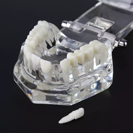 iDENTical All In One Implant Models M2001