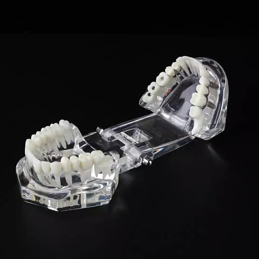 iDENTical All In One Dental Implant Model - M2001 (White)