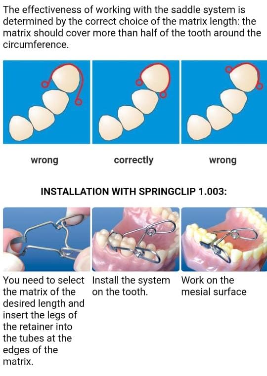 Top Bm Saddle Matrices Kit