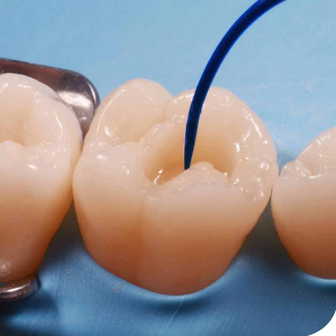 Waldent Plasma+ Composite Instrument Kit of 6 (K14/2)