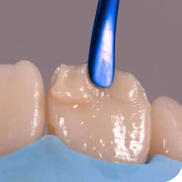GDC Composite Instrument Titanium Blue Silicone Handle Set of 6      - 3