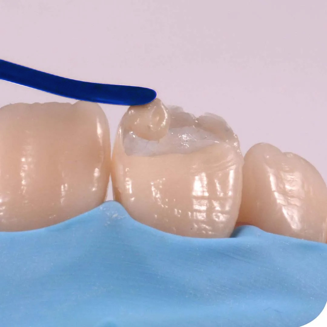 GDC Titanium Coated Composite Instrument Posterior Set Of 5 Pcs (CIPPB5)