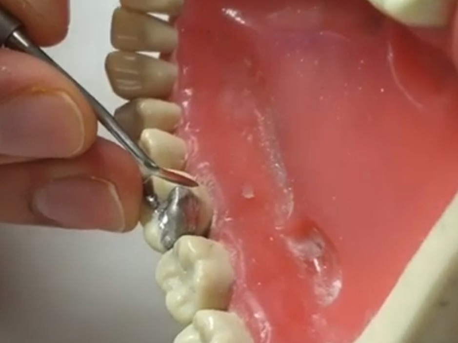 Waldent Ward Carver 15/702