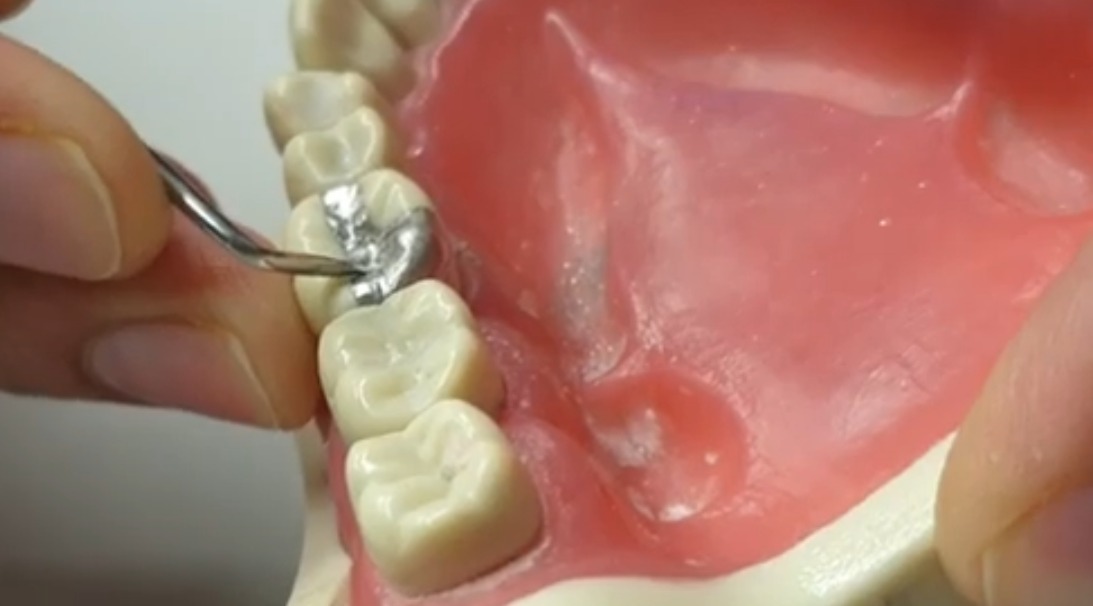 Waldent Ward Carver 15/702