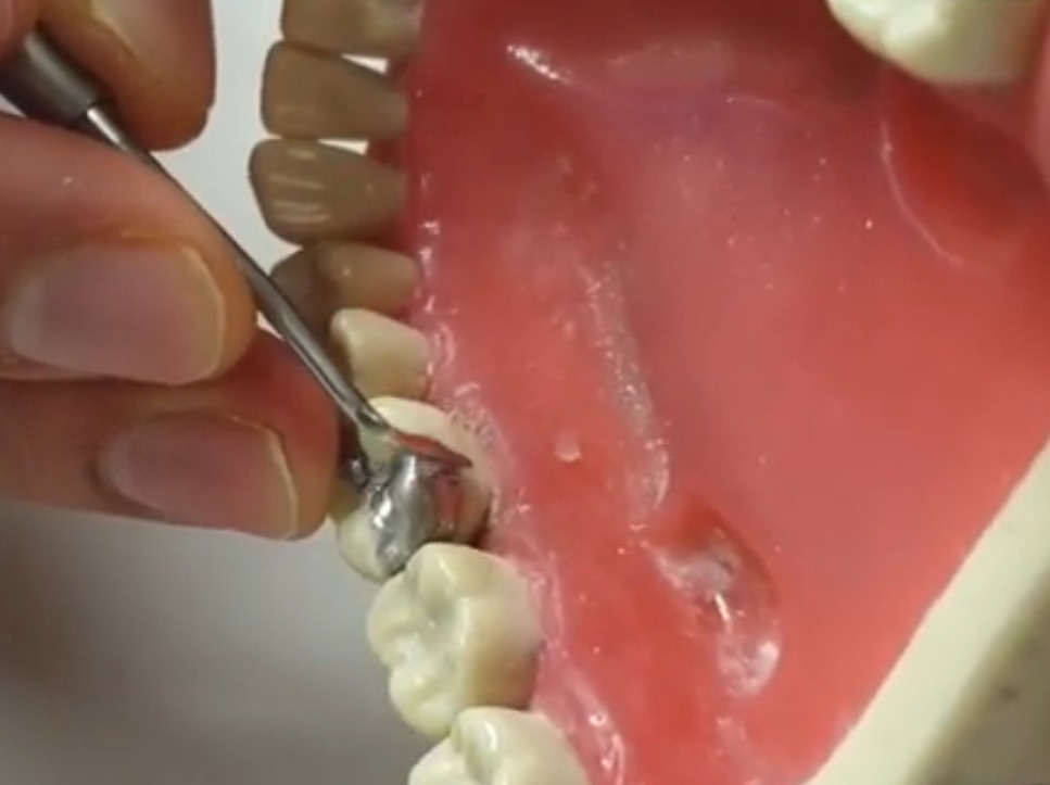 Waldent Ward Carver 15/702