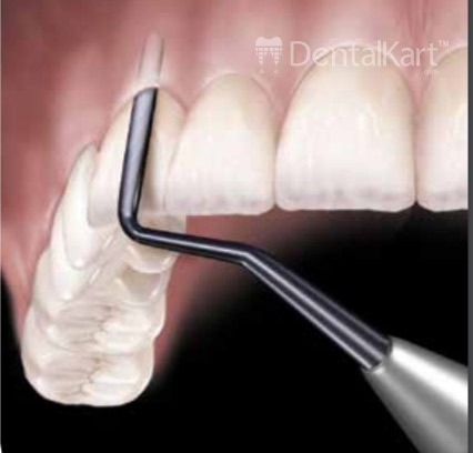 Waldent Periotome Set of 4 (K40/2)