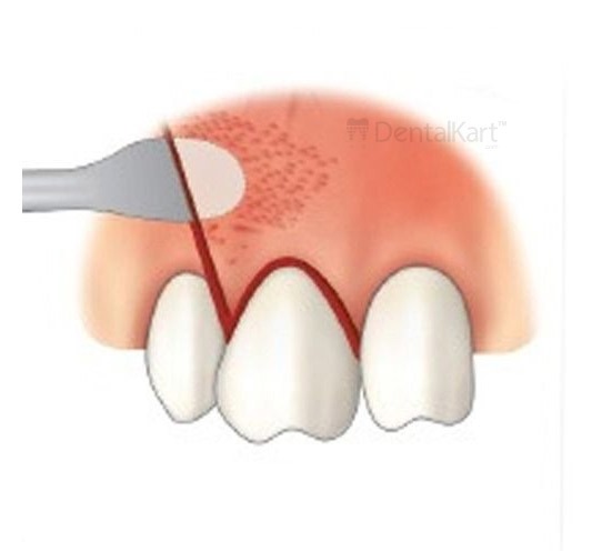 Waldent Oral Surgical Instruments Kit of 10 (K9/1)