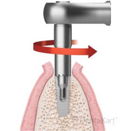 Waldent Implant Ratchet Wrench Dual Sided (19/110)