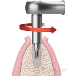 Waldent Implant Ratchet Wrench Dual Sided (19/110)  - 6