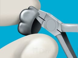 Waldent Orthodontic Band/Crown Crimping Pliers 10/118 - 6