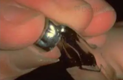 Waldent Orthodontic Ball & Socket Pliers 10/119