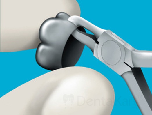 Waldent Orthodontic Ball & Socket Pliers 10/119