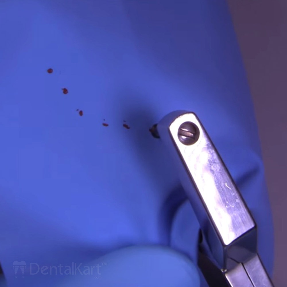 Waldent Rubber Dam Punch Forceps (16/136)