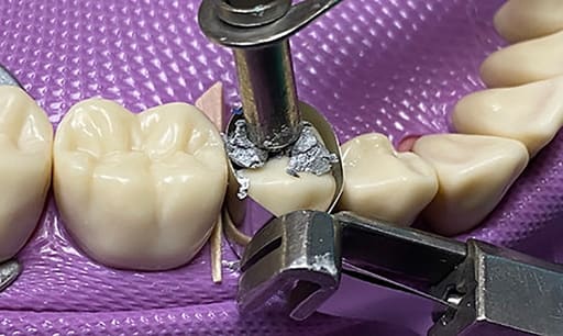 Waldent Amalgam Carrier Double Ended 2.5 x 2.0mm (12/105)