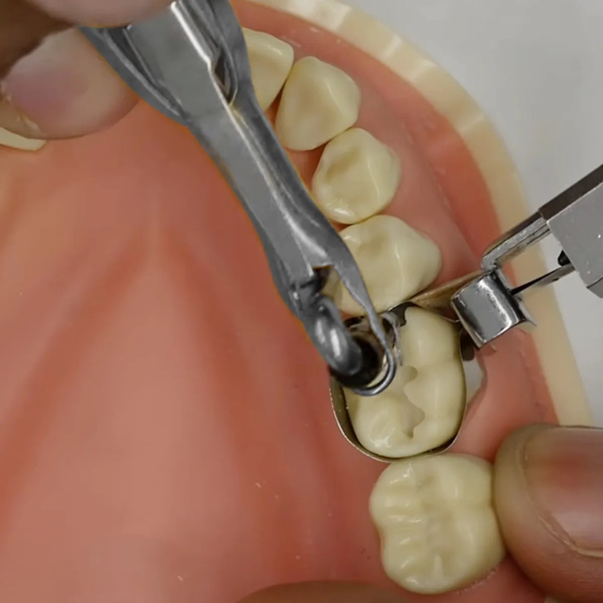 GI Dental Amalgam Carrier