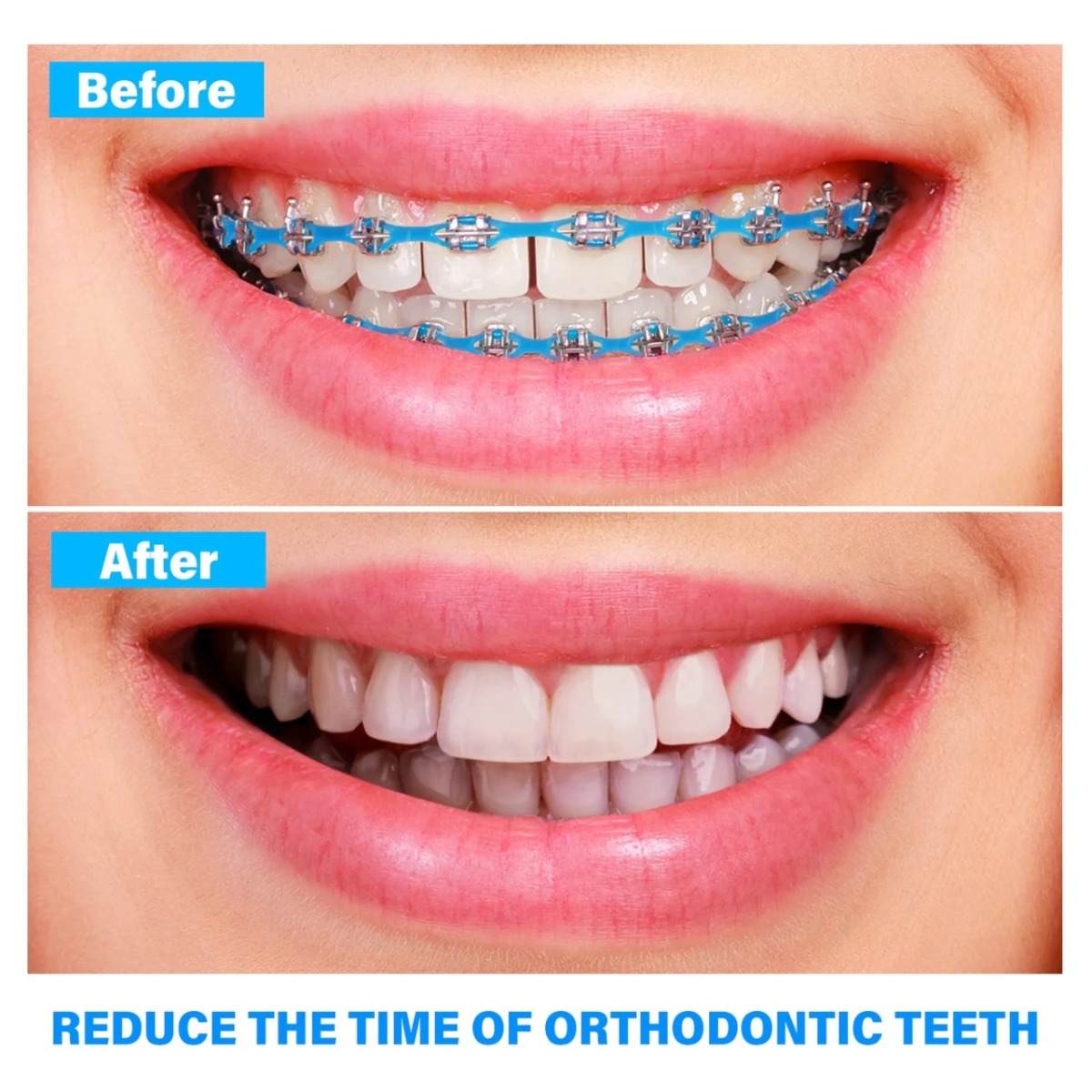 U Ortho E-Chain (15 ft)