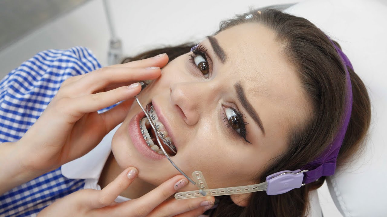 U Ortho Facebow Standard