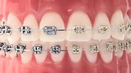 U Ortho NiTi Archwire - Rectangular (pack of 10) - 9