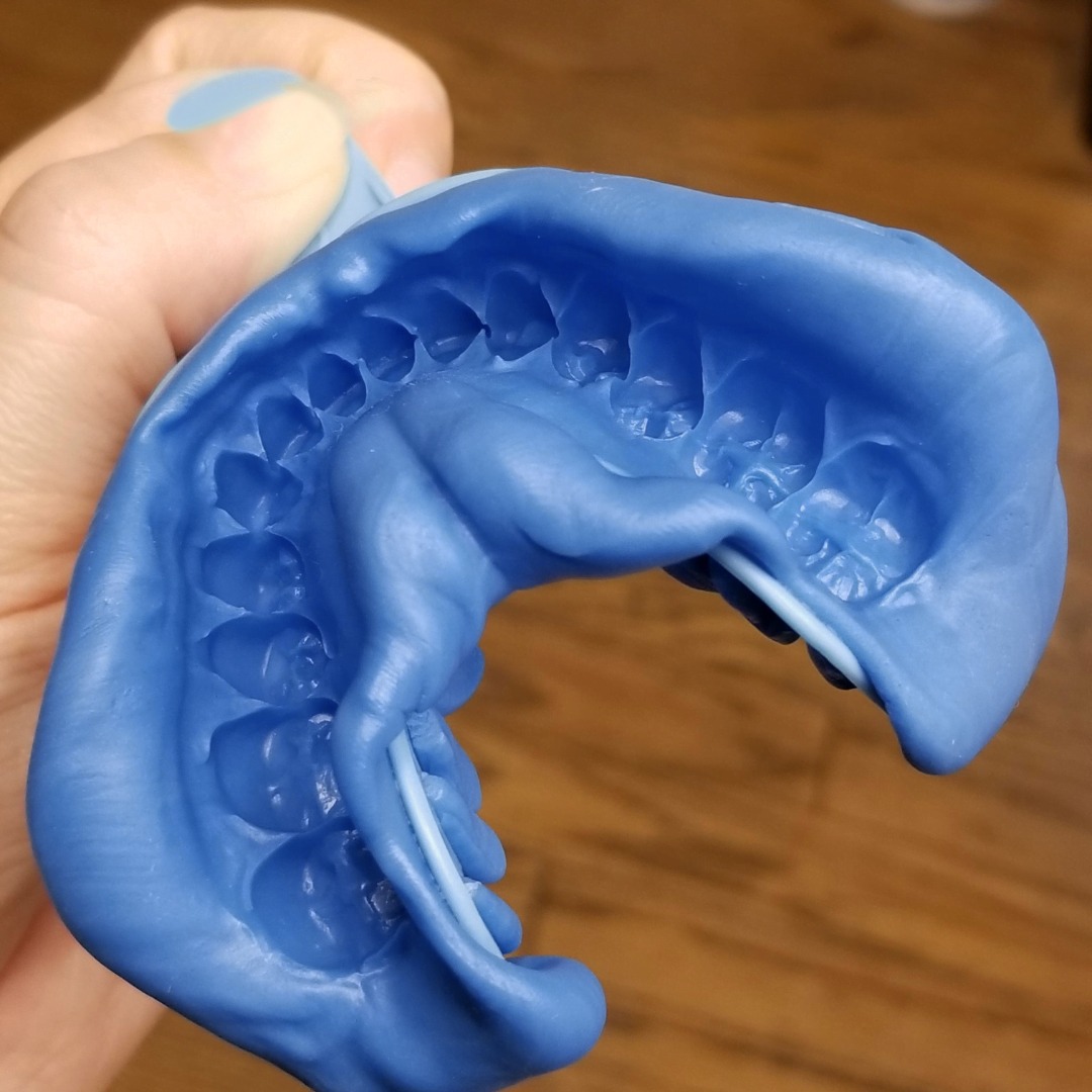 Waldent FlexiGum VPS A-Silicone Putty Impression Material    