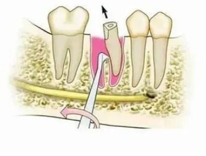 GDC Root Elevators Seldin Standard (E4l)