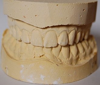 Kalabhai Ultra Rock Die (Brown) Stone (3kg)