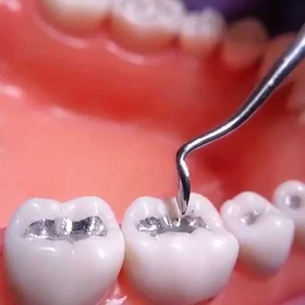 GI Dental Hollenback Carver