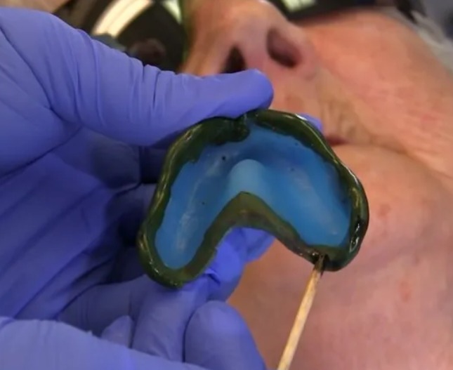 Rolex Tracing Sticks