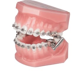 Ormco Advansync 2 Class II Corrector - 1