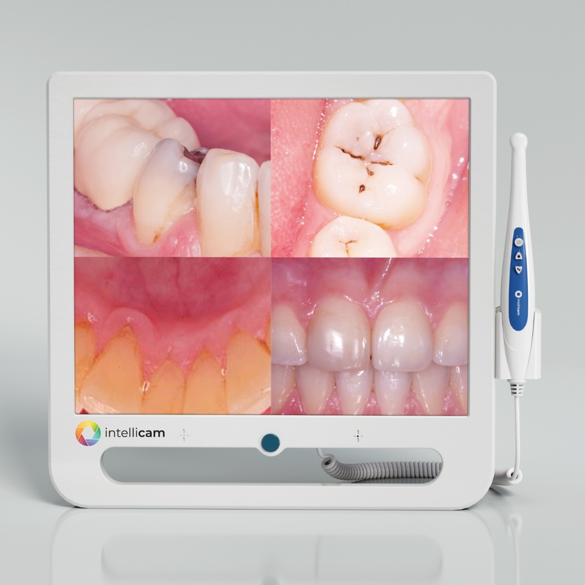 Intellicam 16MP Intraoral Camera with 17" Screen