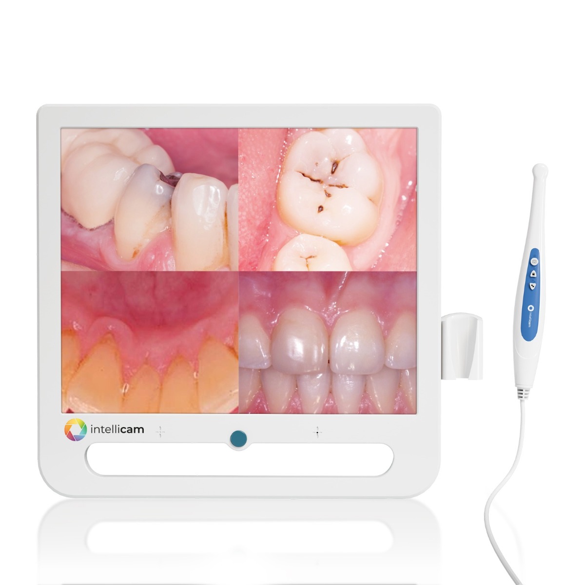 Intellicam 16MP Intraoral Camera with 17" Screen
