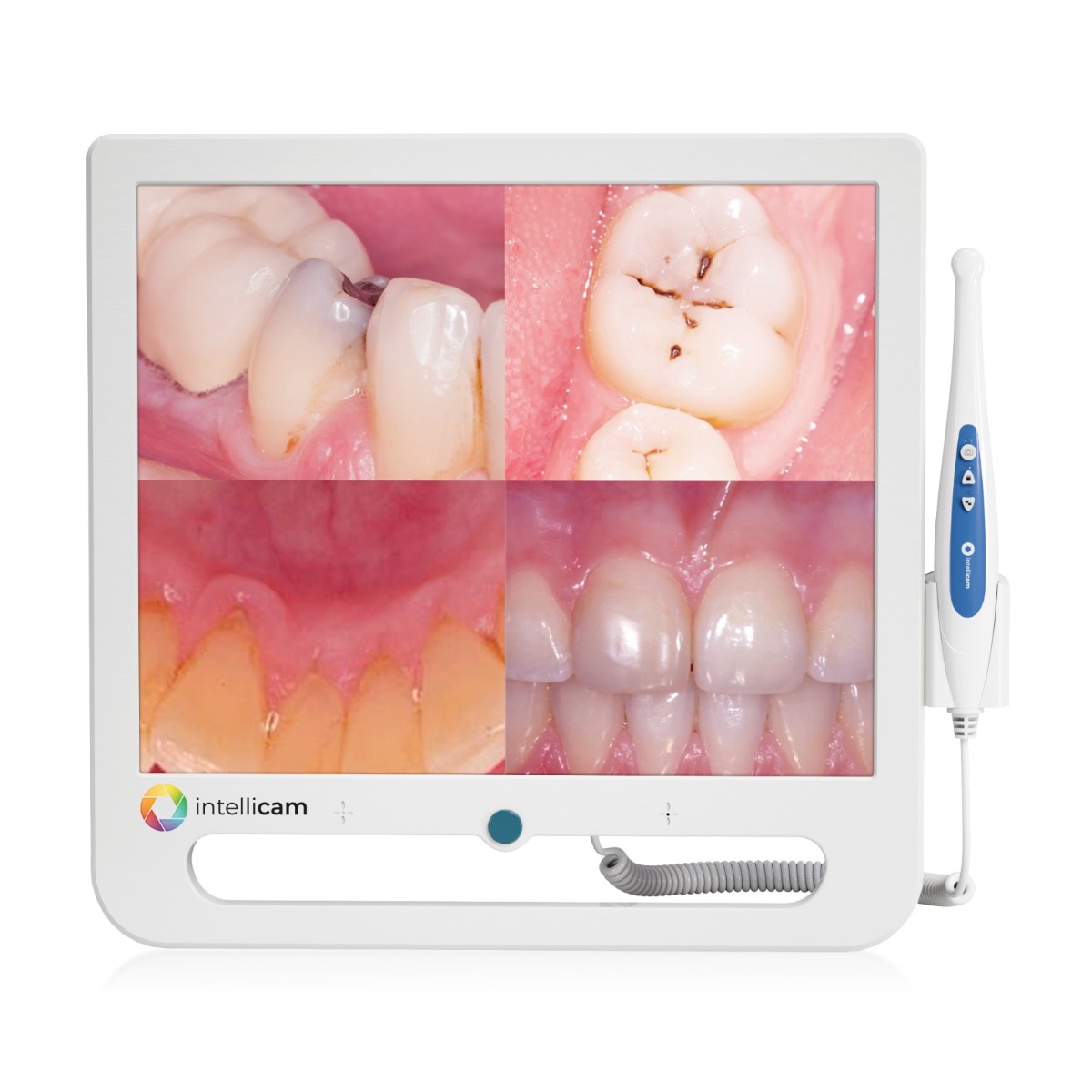 Intellicam 16MP Intraoral Camera with 17" Screen