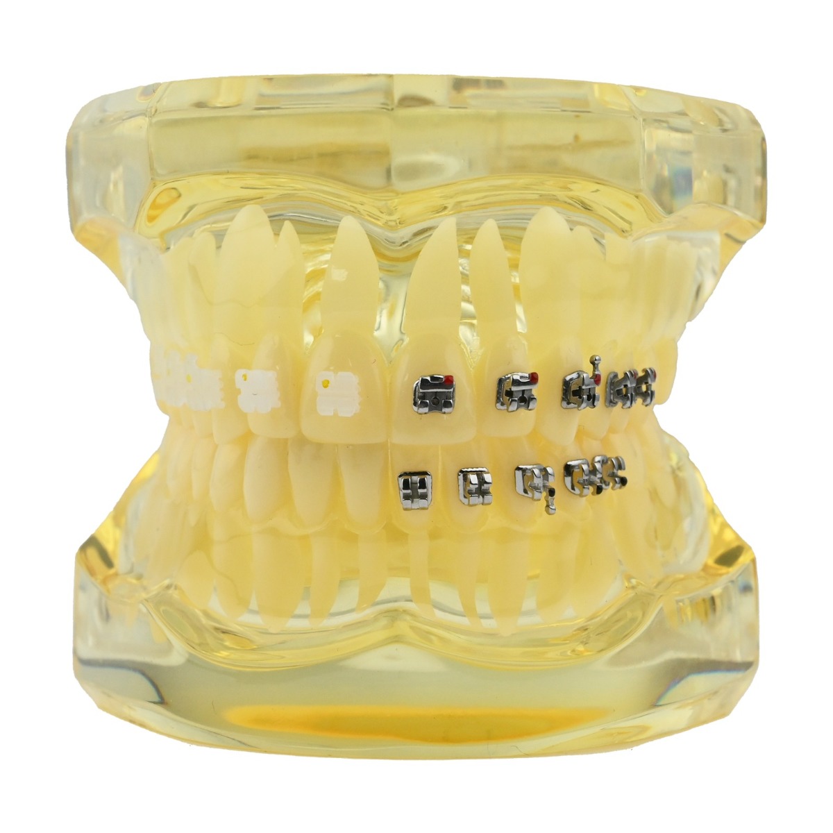 iDENTical Self Ligating Models M3012