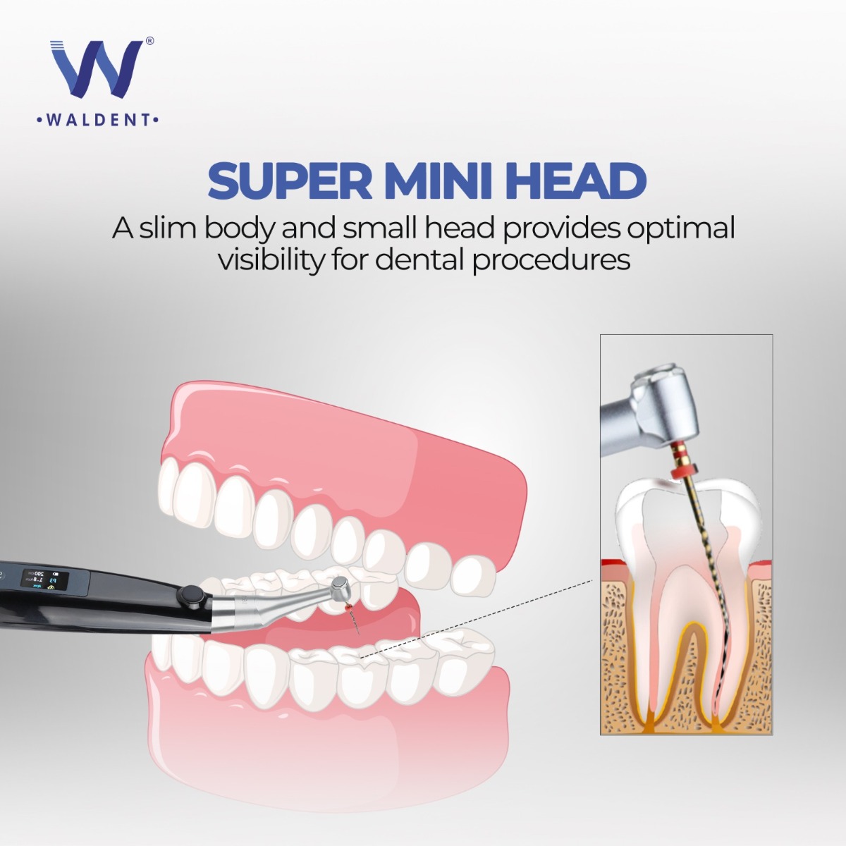 Waldent Smart EndoPro with in-built Apex Locator 