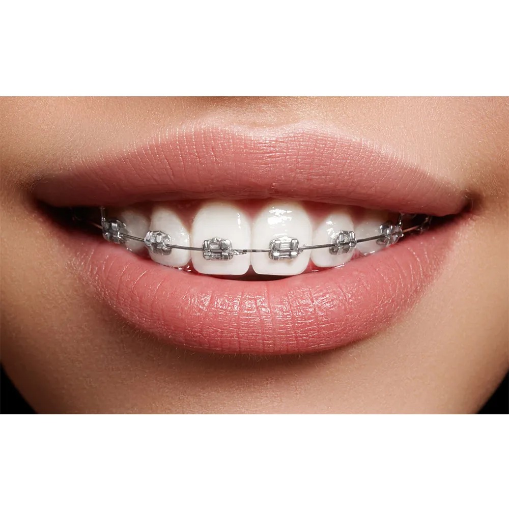 OSL Heat Activated NiTi Ovoid Form Archwires - Rectangular (Pack of 10)