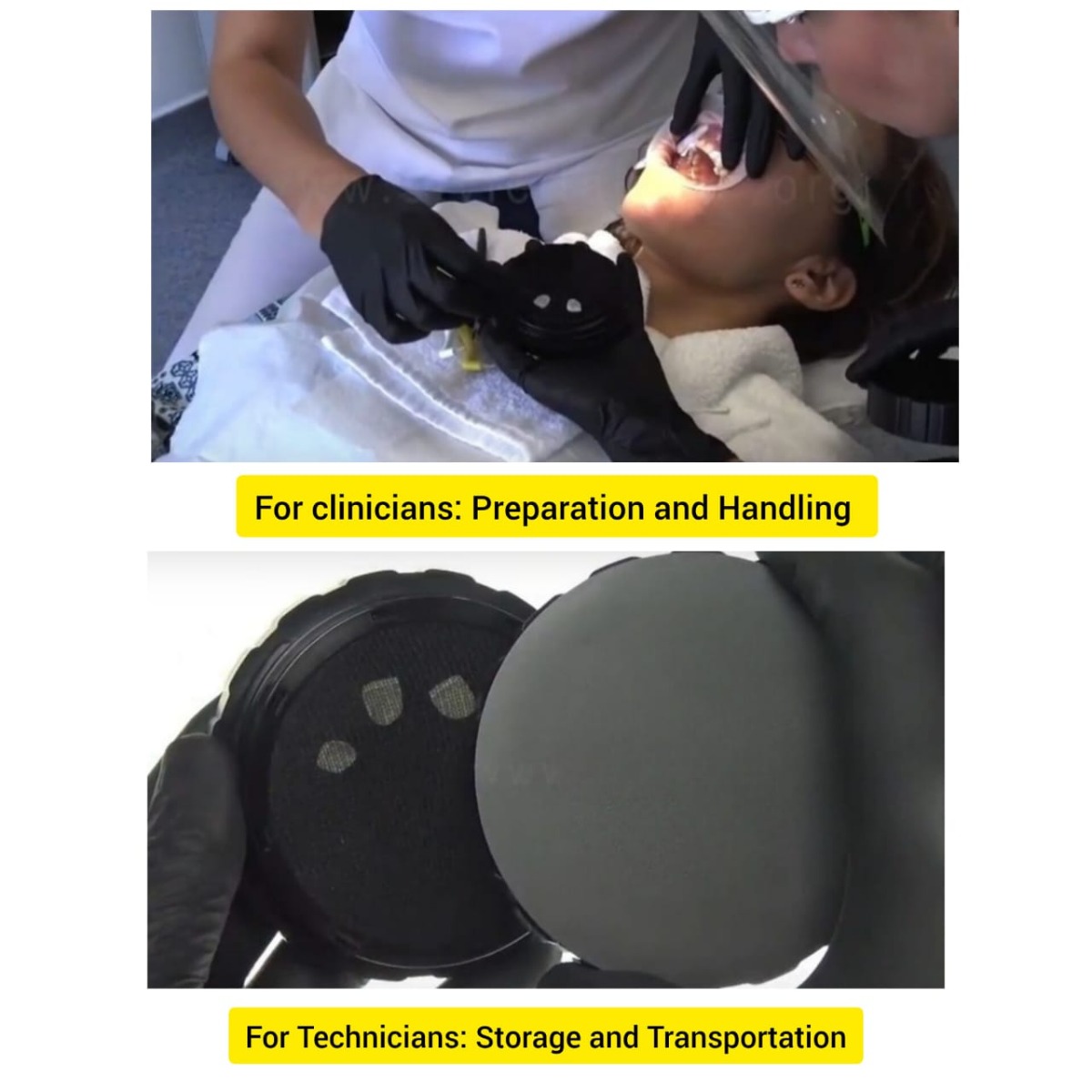 HN Dental Youni Smart Veener Box