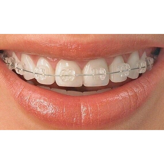 Prime Ortho Clearvue - II Sapphire Brackets Kit Standard MBT 022