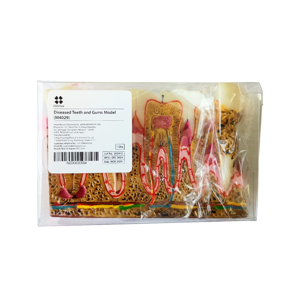 iDENTical Diseased Teeth and Gums Model M4029