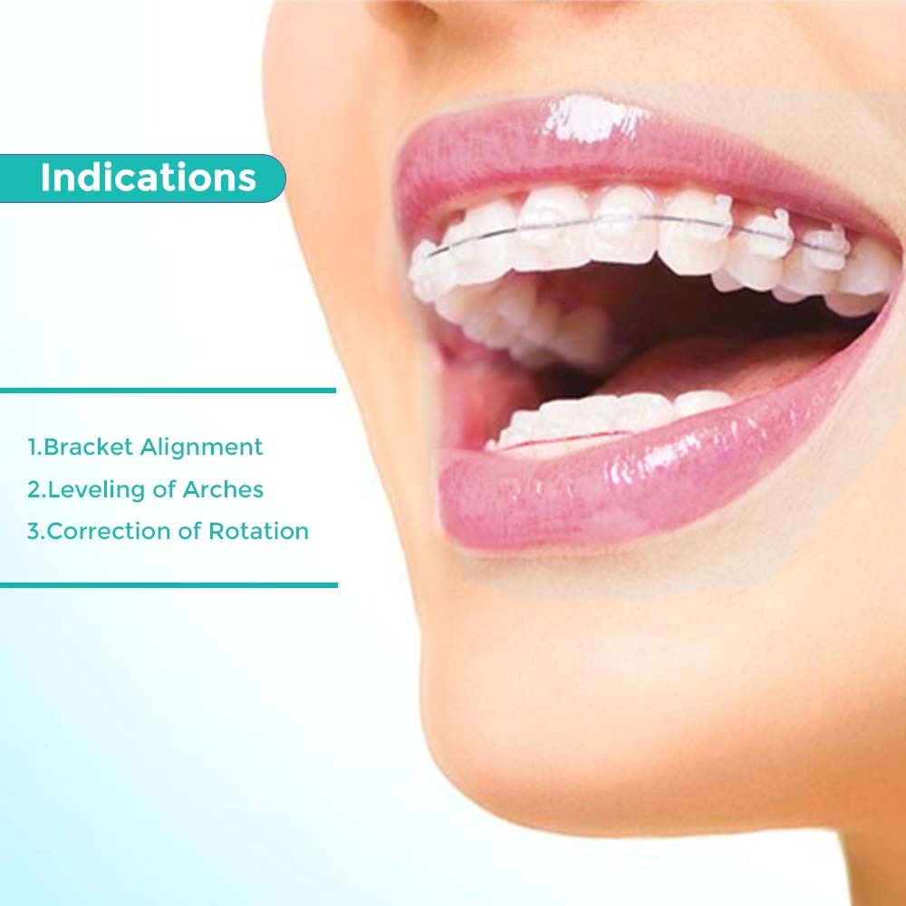 OrthoMetric Flexy NiTi Super Elastic Archwires - Rectangular (10/Pk)