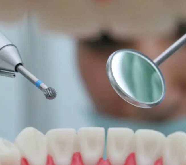 Prima Dental Round Straight Handpiece Carbide Bur (Set of 5)