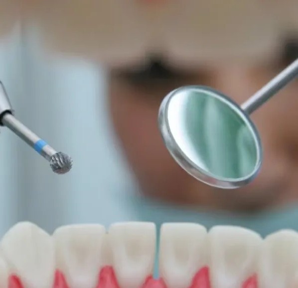 Prima Dental Round Airotor Bur Carbide (Set of 5)