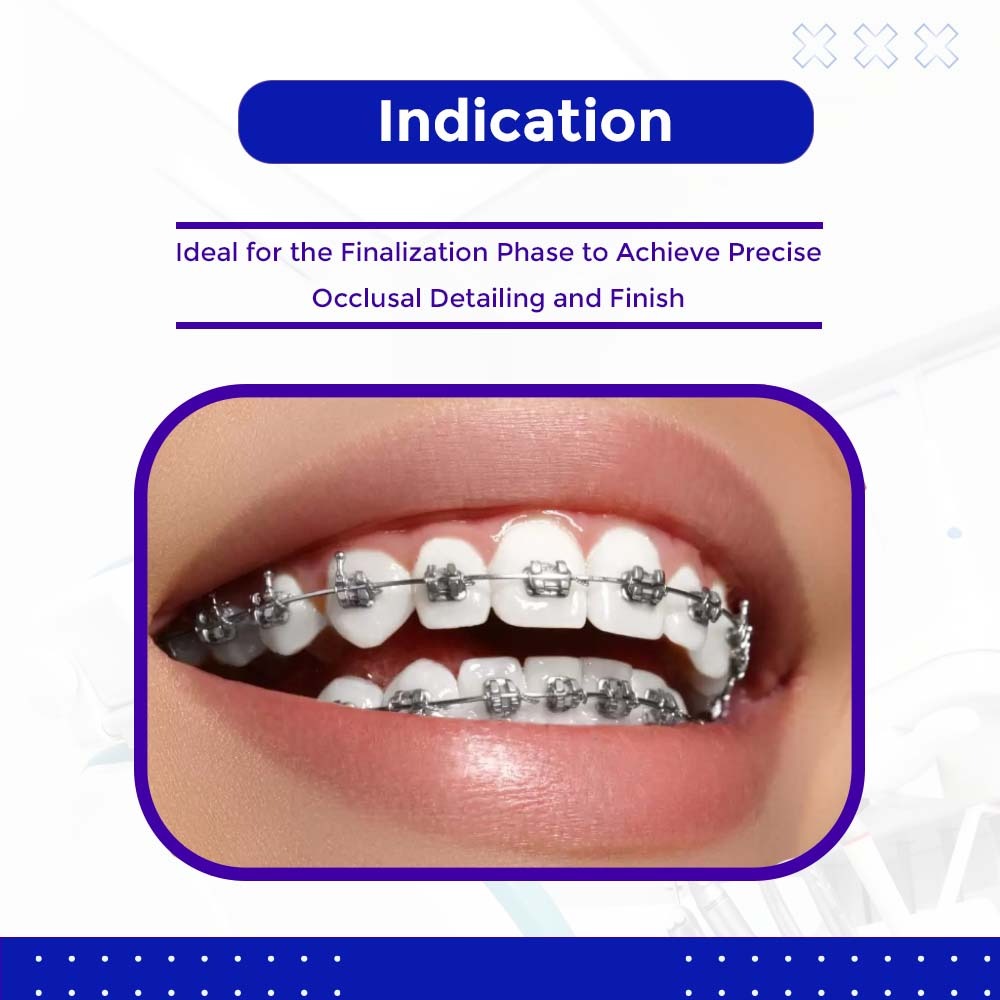 OrthoMetric SS Straight Length Wire (10/Pk)