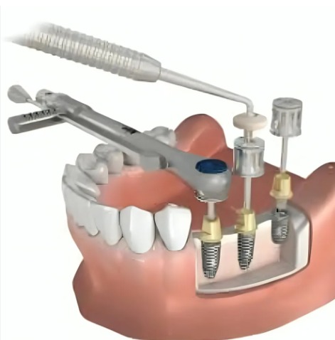 Adin CloseFit NP Hex Driver