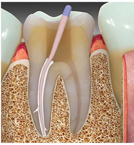 Maarc Rootfyx (9107/1X4)