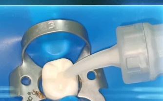 Prevest Denpro Micron Superior Capsules (30010-3)