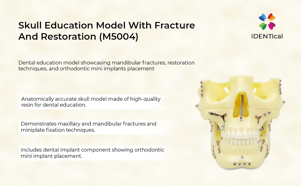 iDENTical Skull Education Model With Fracture And Restoration (M5004)