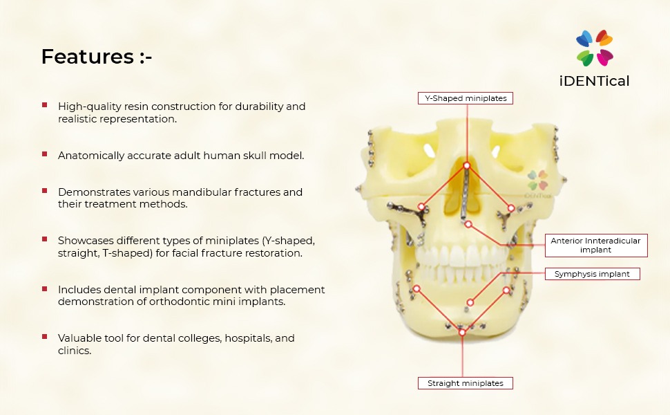 iDENTical Skull Education Model With Fracture And Restoration (M5004)