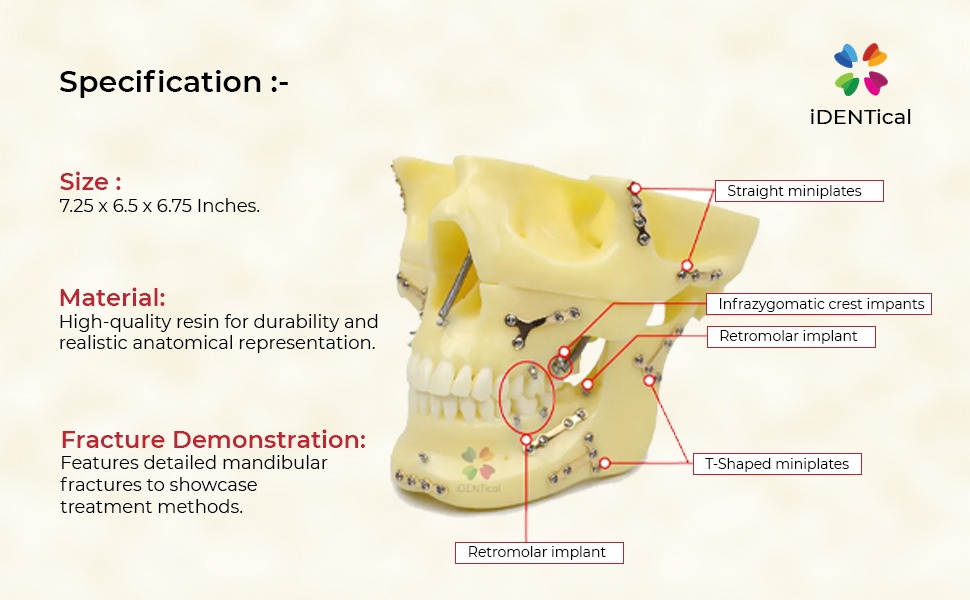 iDENTical Skull Education Model With Fracture And Restoration (M5004)