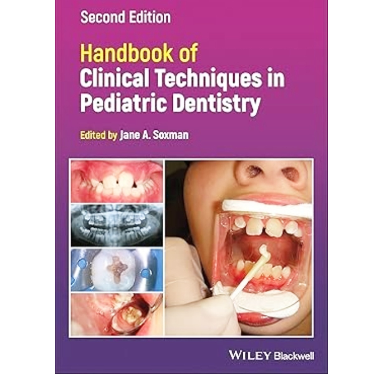Handbook Of Clinical Techniques In Pediatric Dentistry 2nd Edition (ISBN - 661047)