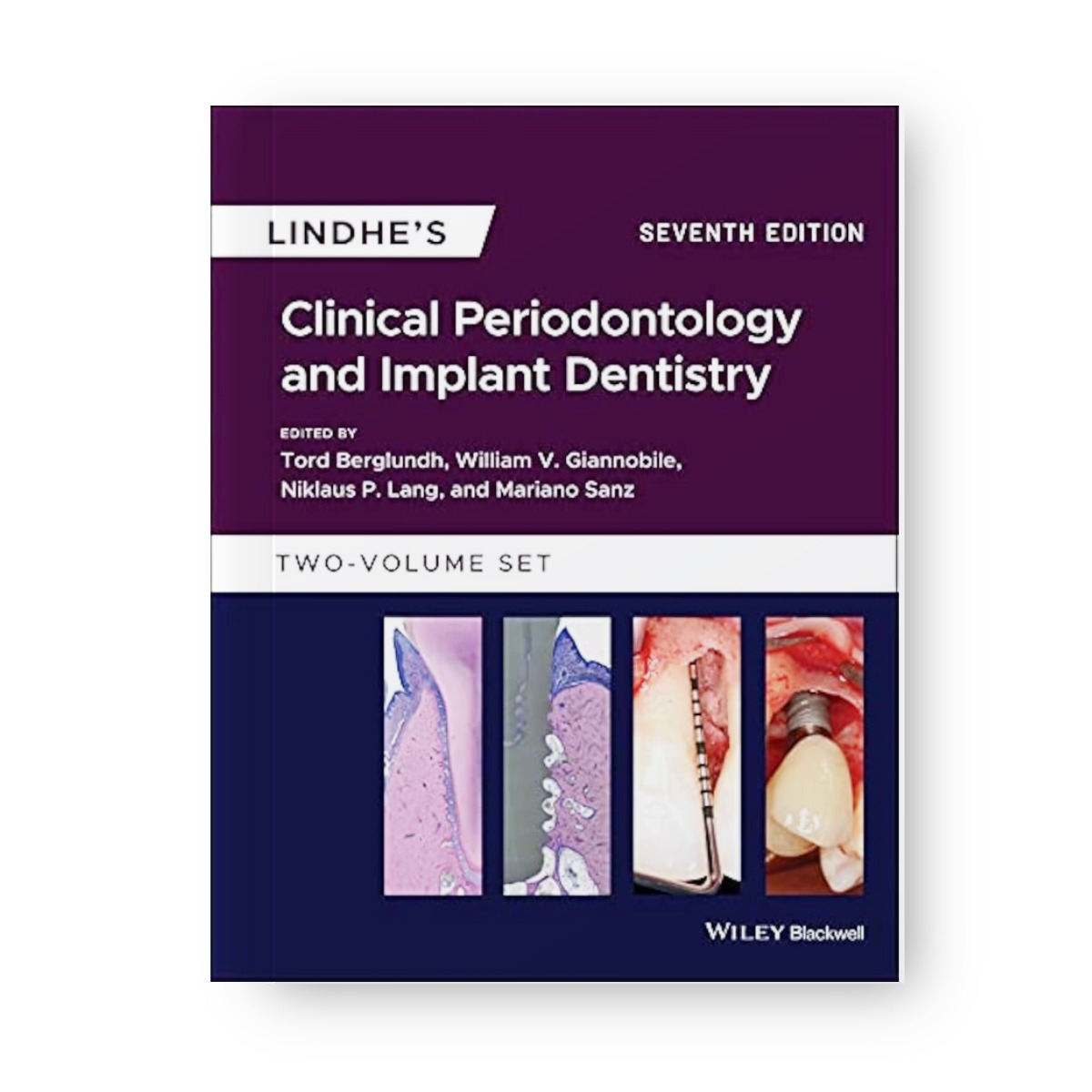 Lindhe's Clinical Periodontology And Implant Dentistry 2 Volume Set 7th Edition (ISBN - 438885)