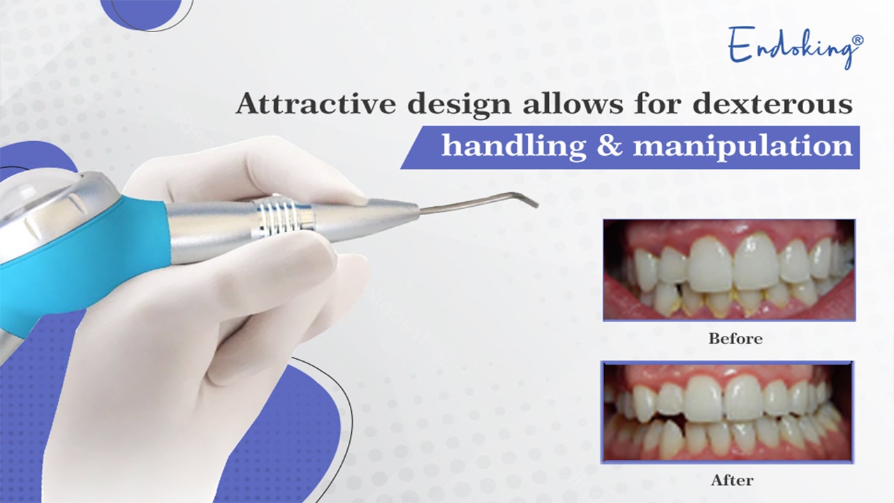 EndoKing Prophyshine Air Polisher